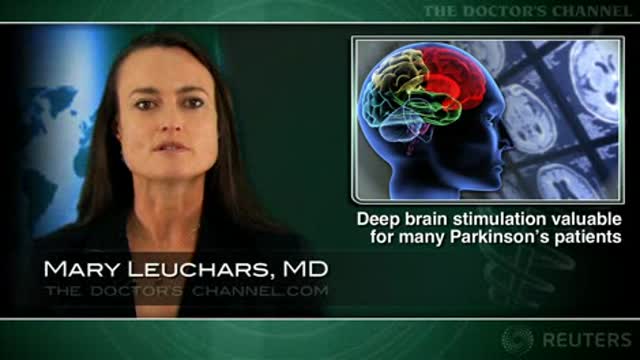 Consensus finds deep brain stimulation valuable for many Parkinson’s patients Thumbnail