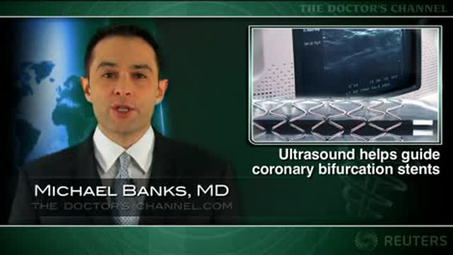 Ultrasound helps guide coronary bifurcation stents Thumbnail