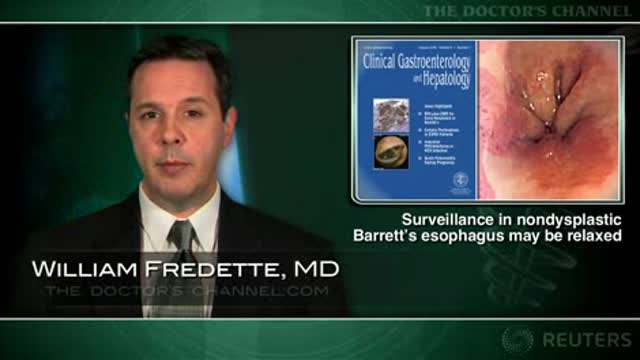 Screening intervals for nondysplastic Barrett’s esophagus might be safely lengthened Thumbnail