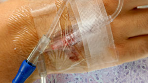 Rituximab improves survival in NHL but doesn’t save money, new analysis finds Thumbnail