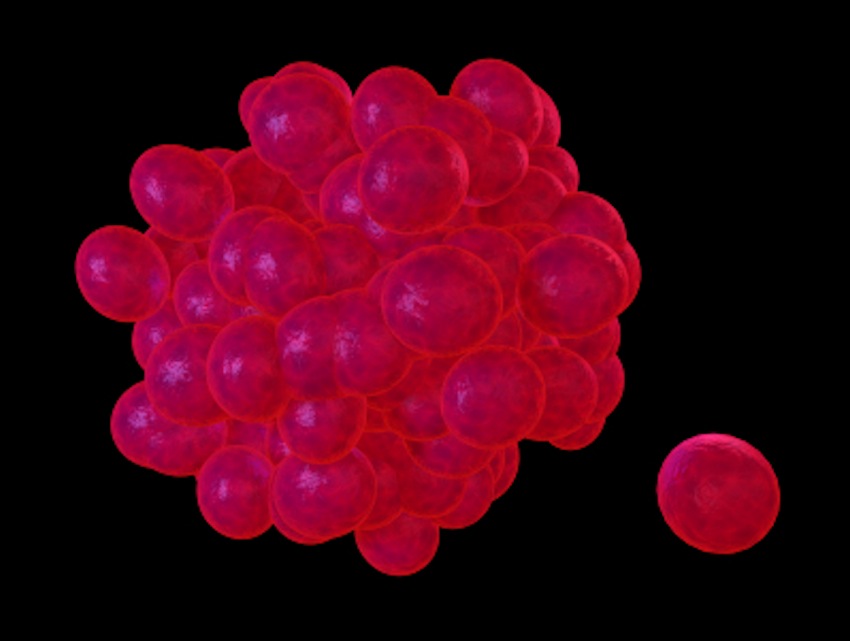 Cancer Genome Atlas Finds Genetic Similarity Between Different Tumor ...