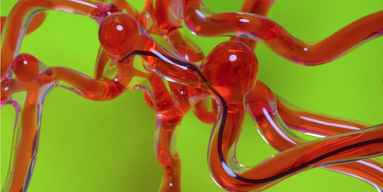 Thread-Like Robot Could Help Doctors Treat Stroke Victims Thumbnail