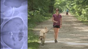 Precision Medicine Research Leads to Screening Test for Early Diagnosis of Hip Dysplasia in Canines