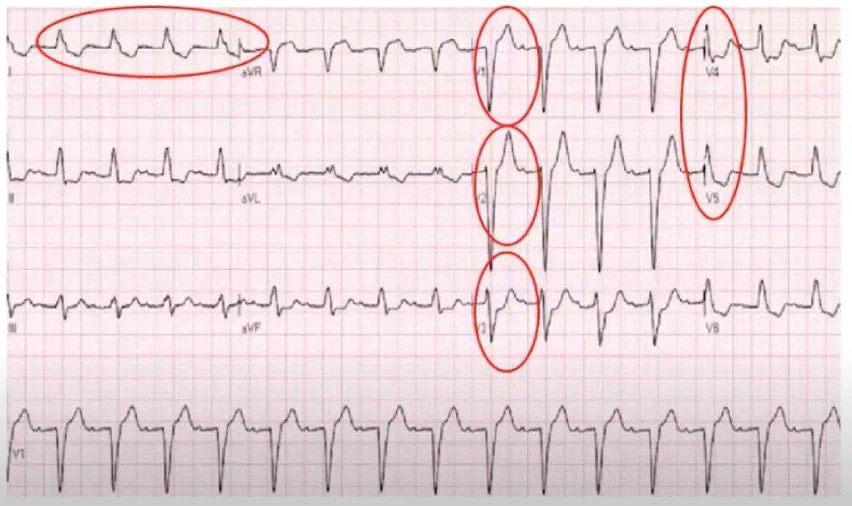 Basic Science of Cardiovascular Disease Thumbnail