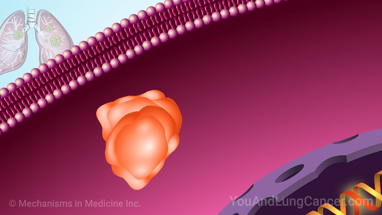 Understanding NSCLC Treatment When You Have a KRAS Mutation Thumbnail