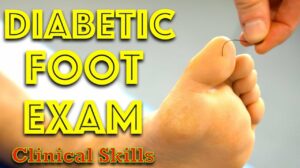 Click to View Diabetic Foot Examination – Clinical Skills – Dr. Gill