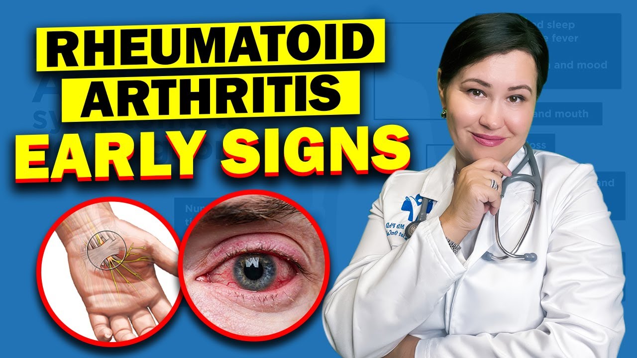 Early Warning Signs Of Rheumatoid Arthritis Thumbnail