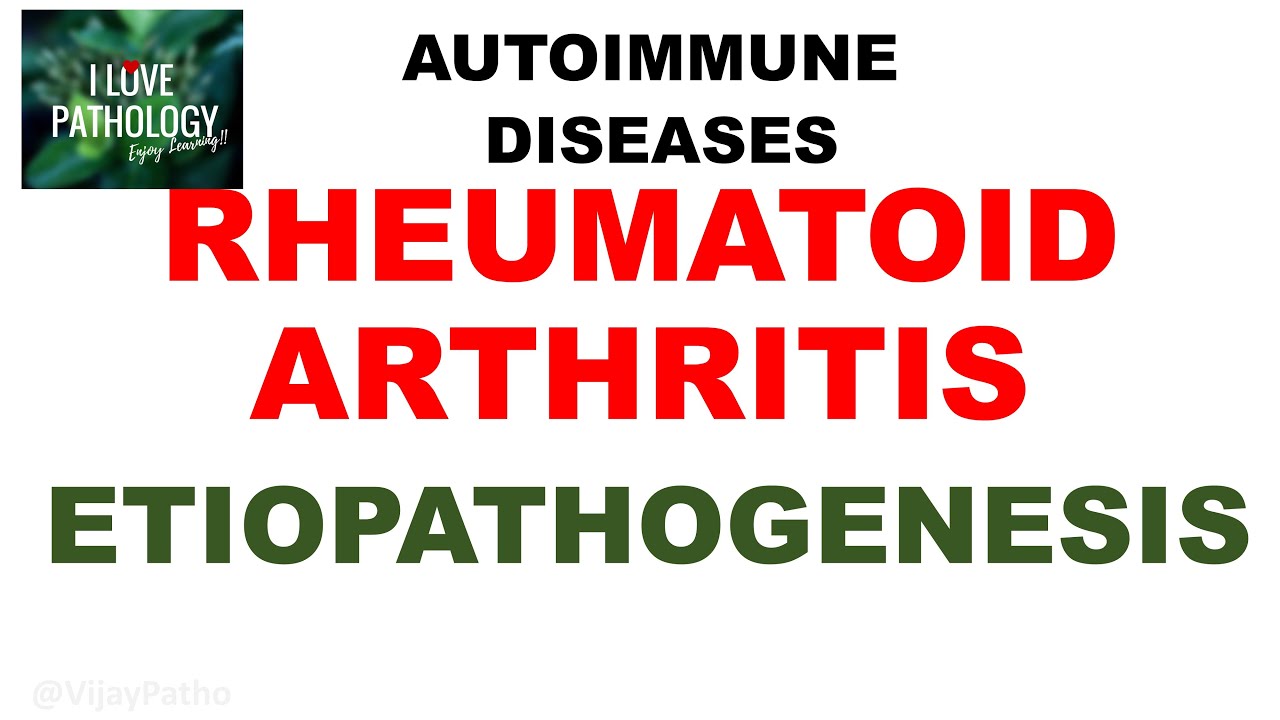 RHEUMATOID ARTHRITIS | PATHOGENESIS Thumbnail