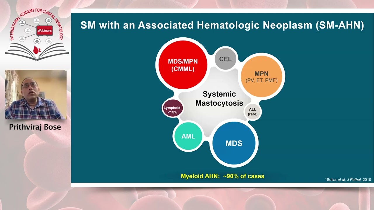 Diagnosis and Management of Systemic Mastocytosis: What’s New in 2024? Thumbnail