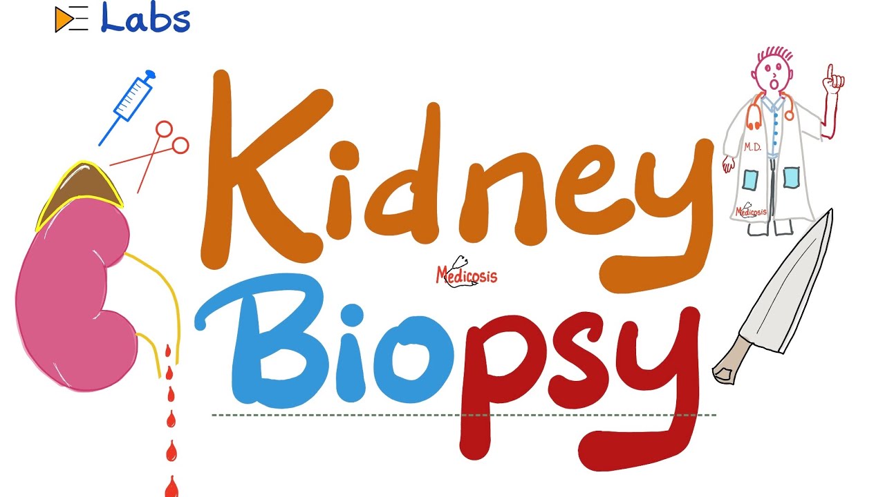 Kidney Biopsy (Taking a Sample of the Kidney) – Nephrology Labs Thumbnail