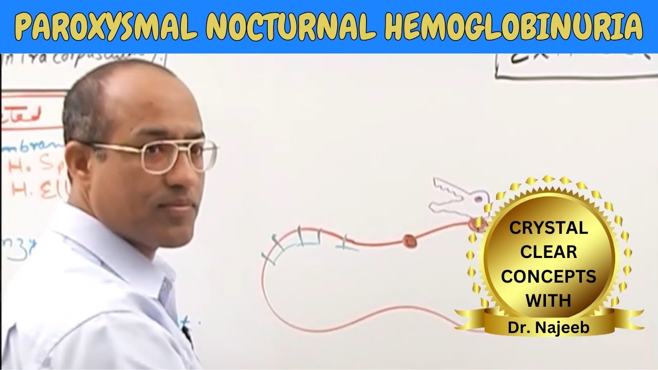 Paroxysmal Nocturnal Hemoglobinuria | Pathophysiology Thumbnail