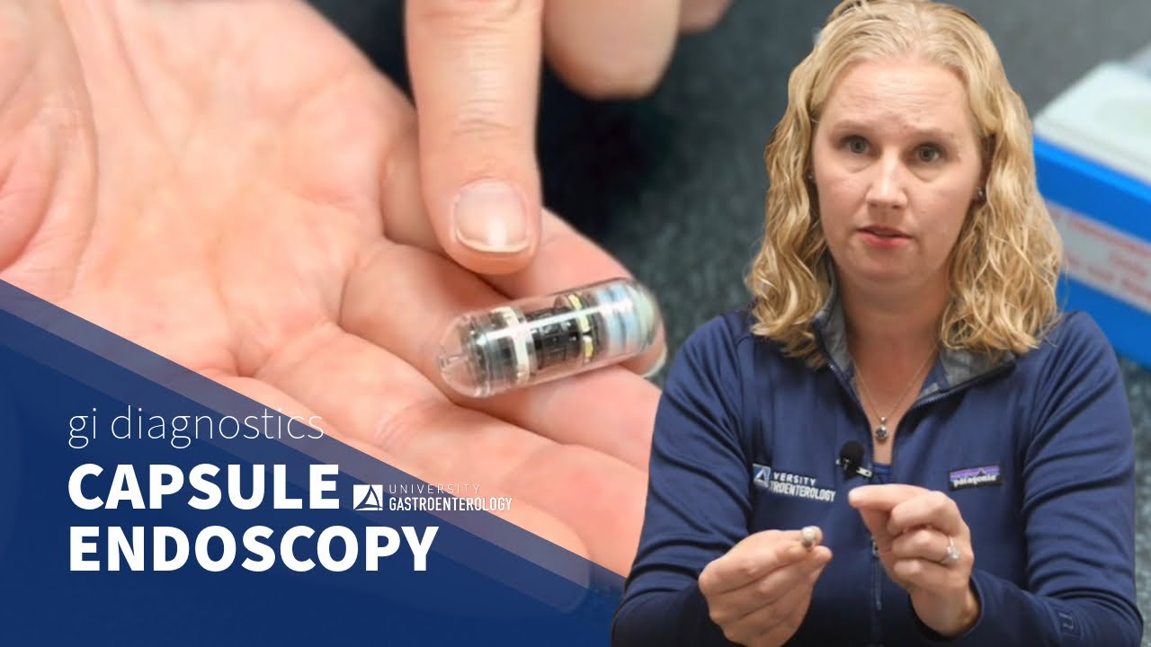 GI Diagnostics: What is Capsule Endoscopy? Thumbnail