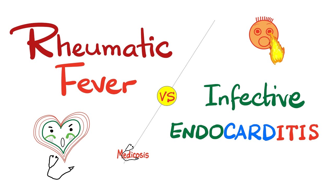 Rheumatic Fever vs Infective Endocarditis – Comparison – Cardiology Series Thumbnail