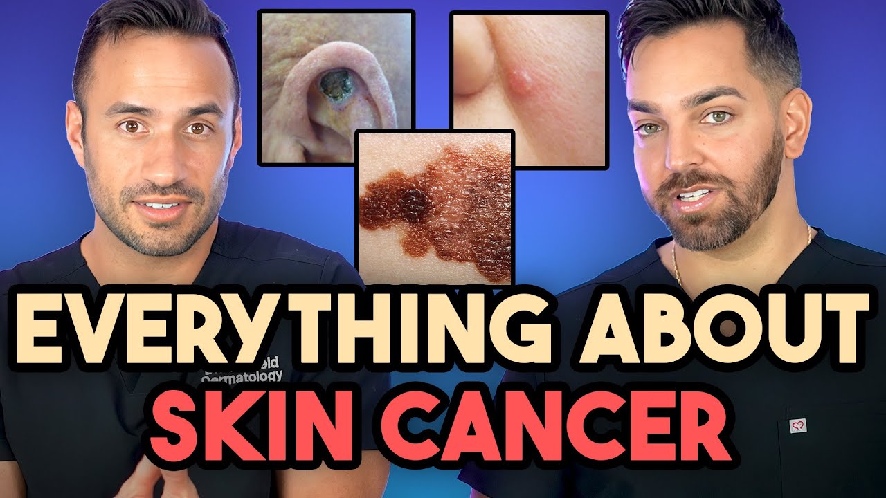 Everything About Skin Cancer: Prevent, Identify, Biopsy, and Treatment | Dermatologist Explains Thumbnail