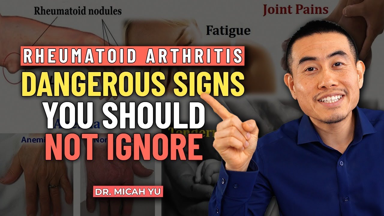 Serious Complications of Rheumatoid Arthritis | Rheumatologist Micah Yu, MD Thumbnail