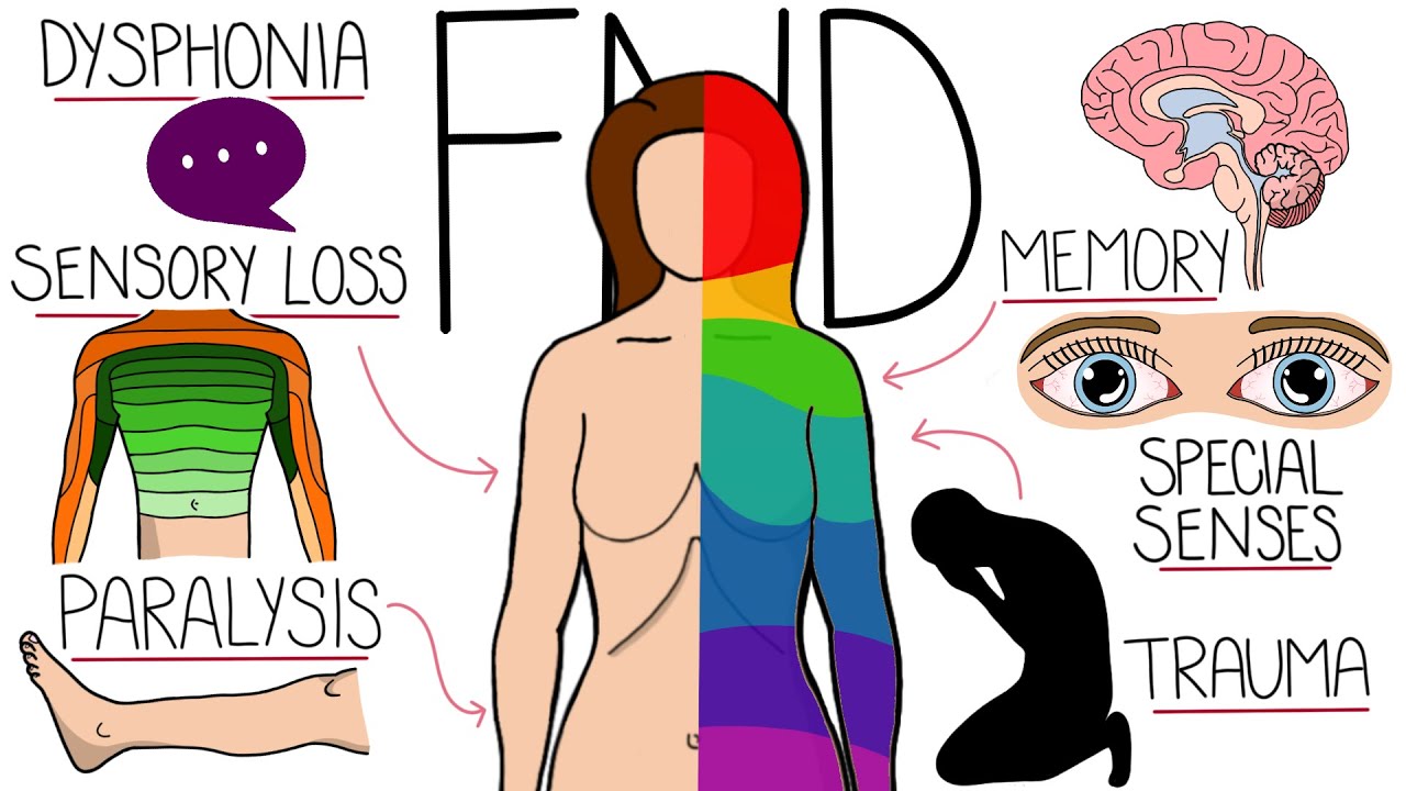 Functional Neurological Disorder (FND) Explained Clearly Thumbnail