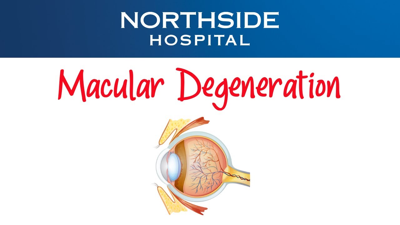 Age-Related Macular Degeneration: Causes, Symptoms, and Treatment Options Thumbnail