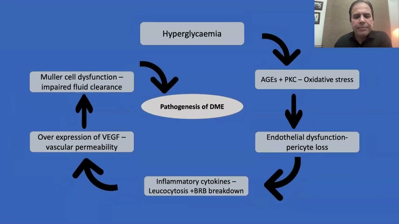 Lecture: Approach to the Management of Diabetic Macular Edema Thumbnail