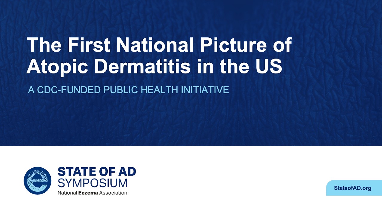 The State of AD Symposium Thumbnail